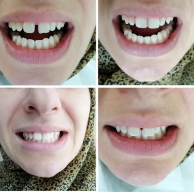 Dt. Cansu Kahveci Kılıç profil fotoğrafı